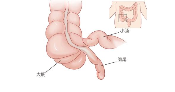 什么是小儿急腹症 儿童急腹症病因是什么