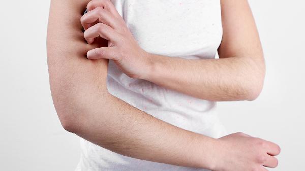 皮肤过敏可以喂母乳吗 产妇皮肤过敏注意4方面