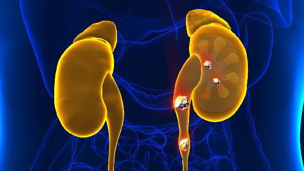 不典型膜性肾病是什么意思