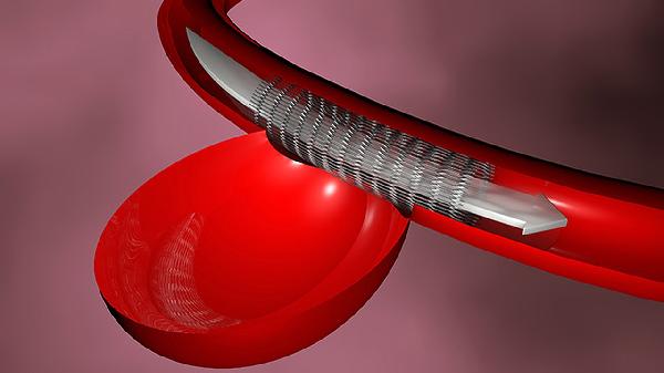 低钾血症跟低血糖有什么区别