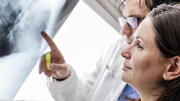 肺部磨玻璃结节意味着什么