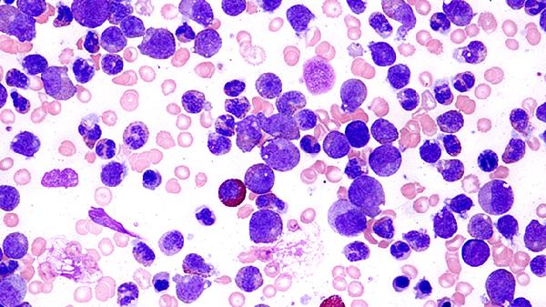 疱疹病毒一辈子携带吗