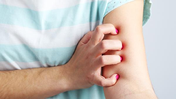 鱼鳞病冬季皮肤干燥怎么办