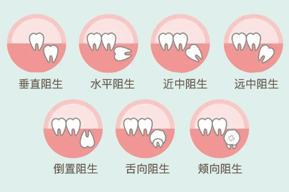 智齿肿了可以拔吗