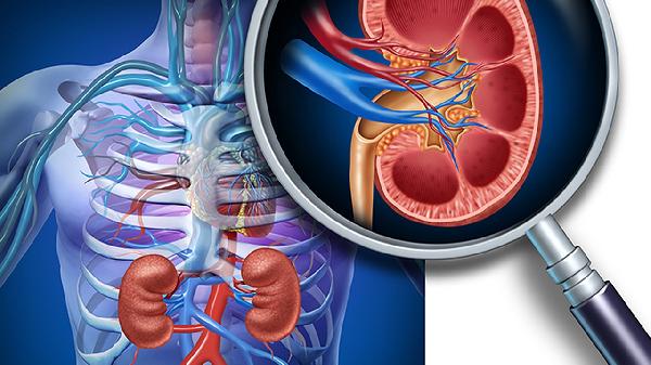 经皮肾镜取石术是什么 经皮肾镜取石术优缺点分析
