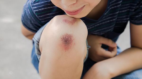 左腿肚子酸胀是怎么回事