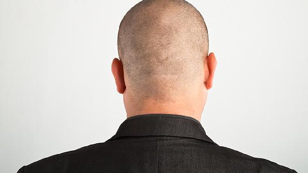 男性龟头发红不疼不痒怎么回事