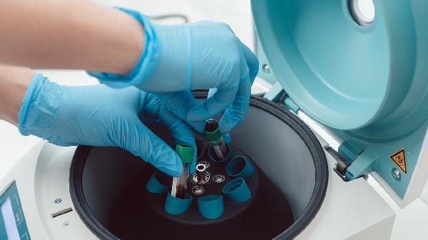 血常规检查能测出血友病吗 如何检查出血友病