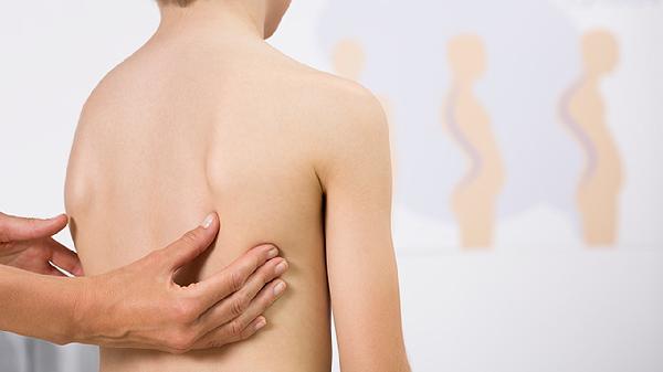 骨筋膜室综合征晚期并发症有哪些