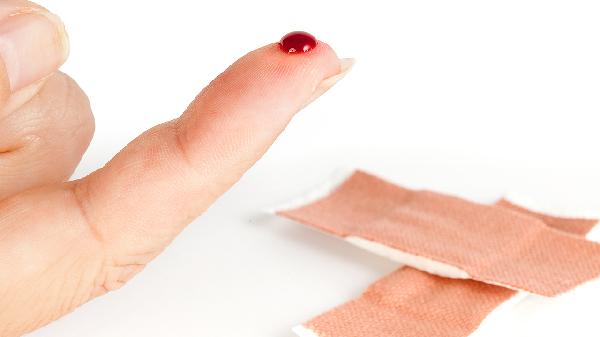 伤口愈合是什么样子 伤口愈合有三个症状