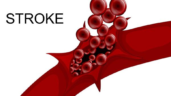 低钾血症的并发症有哪些 低钾血症竟然还会引起4个并发症