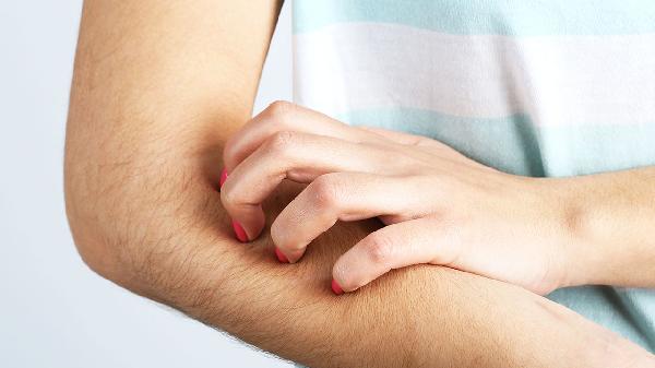 皮肤过敏初期怎么护理 四方面护理呵护好你过敏皮肤