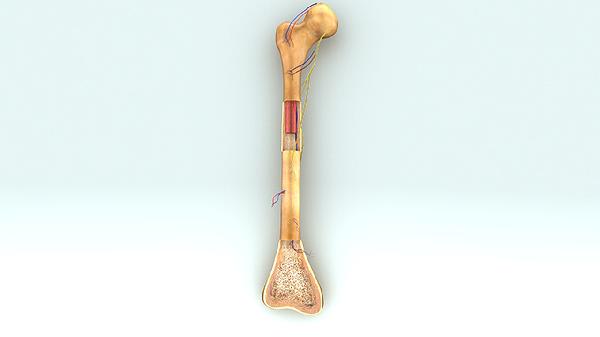 骨纤维异常增殖症是癌吗