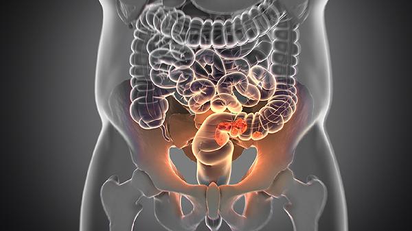 直肠下垂如何恢复正常 四步解决直肠下垂问题