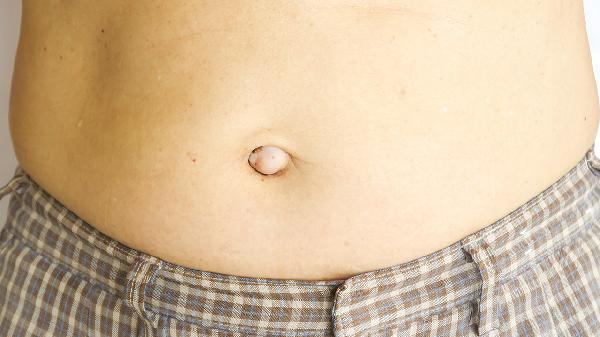 肚脐眼里的泥好臭怎么回事