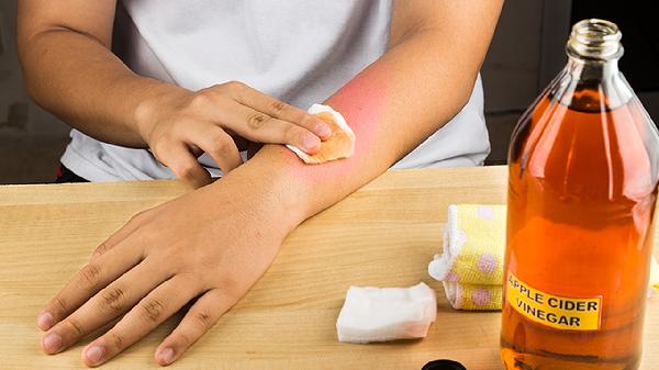 75的酒精和碘伏哪个杀菌更好