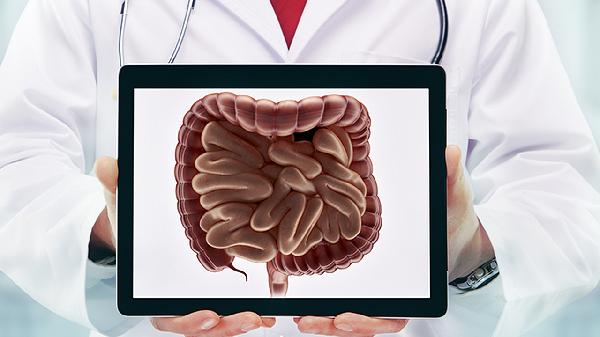 幼年直肠息肉会复发吗 幼年直肠息肉的复发原因细说