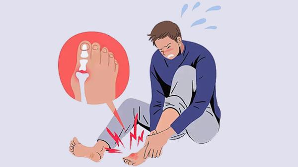 骨折了吃什么促进骨头愈合快些