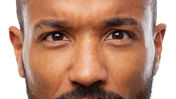 眼睛下眼睑红肿还疼是什么原因引起的