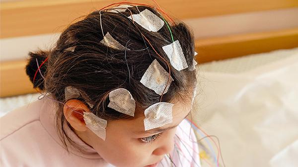 小儿颅内压增高引起的中枢神经系统症状有哪些