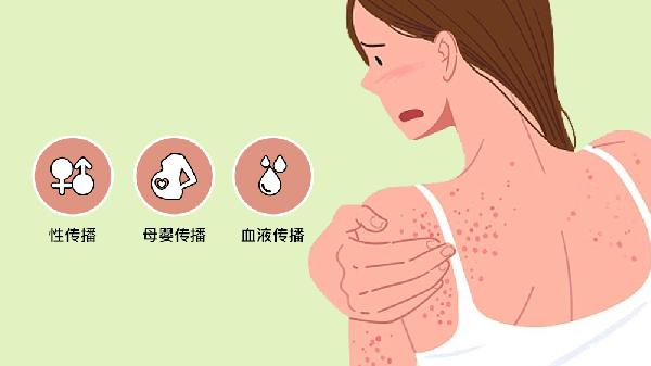 如何治疗先天性梅毒效果比较好