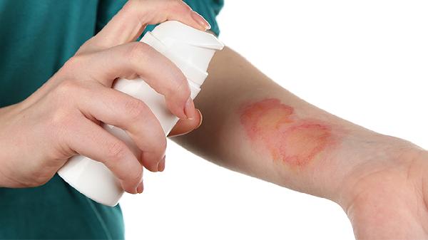 疝气手术三年伤口疼挂什么科