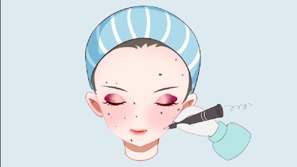 手术去痣的四个操作步骤