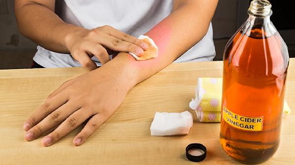 镊子用碘伏擦一下算消毒吗