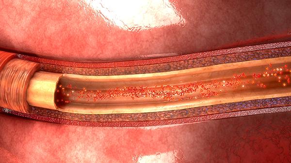 每个人都担心癌症“上门” 既然如此 不妨牢记这几个小建议