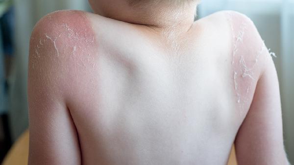 外伤牙断了做什么检查