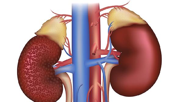 肾小球病变尿液中会出现什么