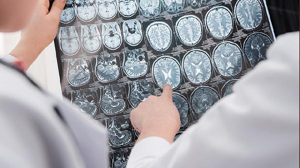 脑囊虫病怎么办 揭晓脑囊虫病的正确处理方法