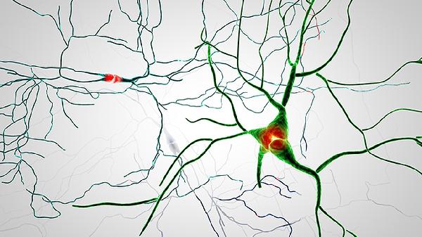 老年人多发性神经病临床表现有哪些