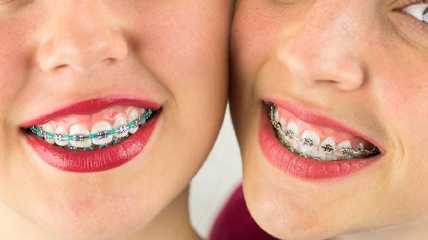 刷牙时牙齿酸痛是什么原因导致的