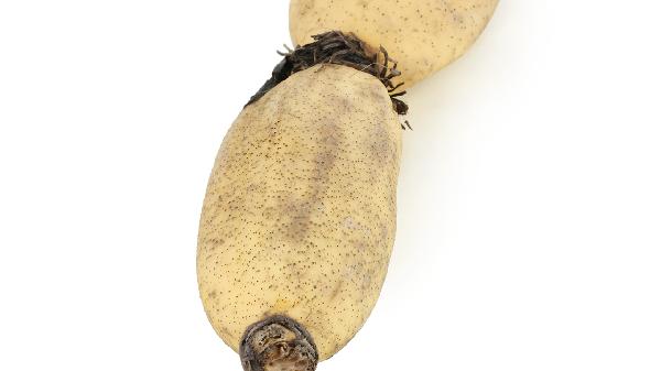 怎么治疗植物性神经官能症