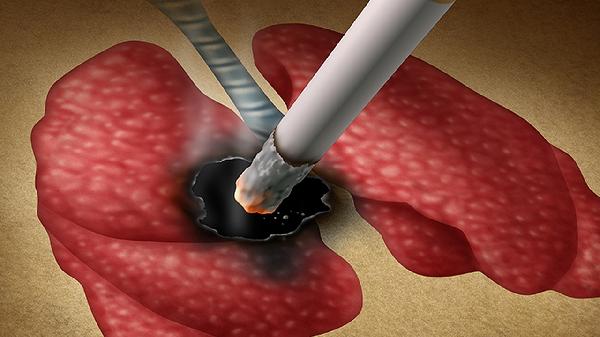 吸烟是不是肺癌的危险因素