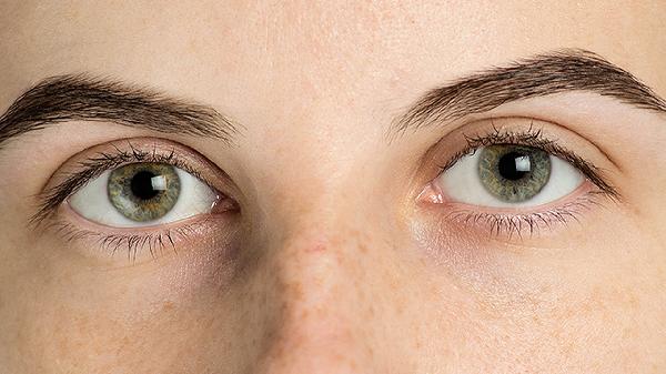 大小眼困扰你吗 这样改善 让你的眼睛更迷人