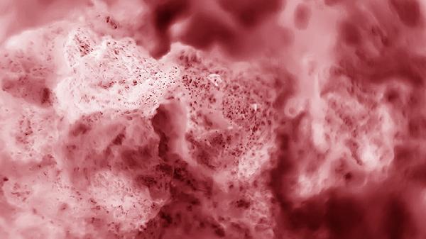 舌下腺囊肿初期症状是怎么样的