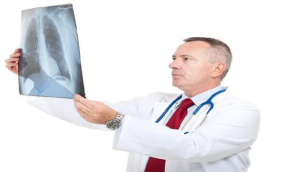 肺脓肿会发展成肺癌吗 了解肺脓肿和肺癌的关系