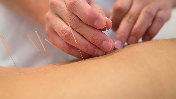 梨状肌综合征如何理疗 介绍梨状肌综合征的理疗方法