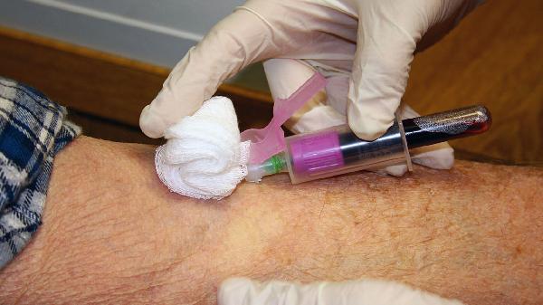 血脂高能吃红烧肉吗