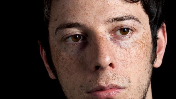 龟头上有红色斑块是怎么回事