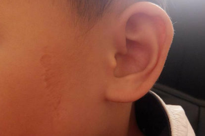 耳朵里面痒用什么药