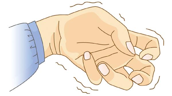 顽固性癫痫如何确诊 顽固性癫痫的确诊方法介绍