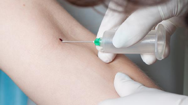 双胞胎输血综合征是什么 从三大方面带你了解这一疾病