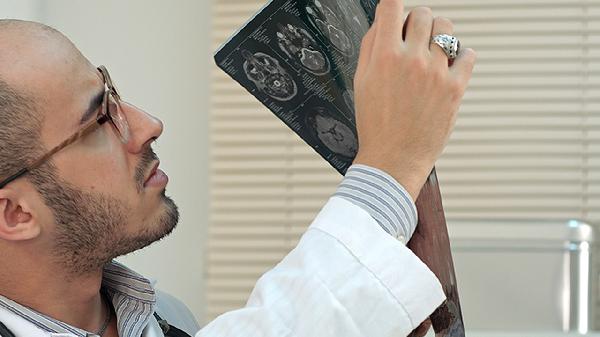 结核性脑膜炎有何临床表现