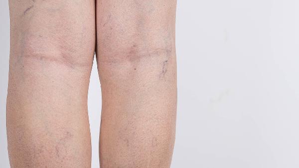 肛门括约肌痉挛的症状有哪些