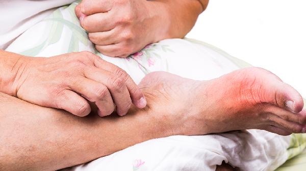 大脚骨突然红肿疼痛怎么办