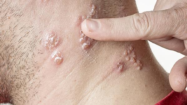 颈部CT和肺部CT可以一起做吗