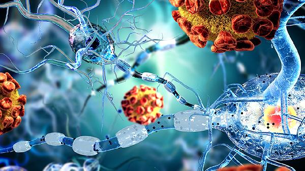 慢性嗜酸性粒细胞的诊断方有哪些